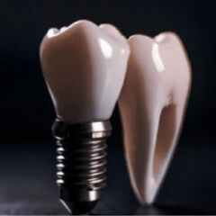 Implant restoration